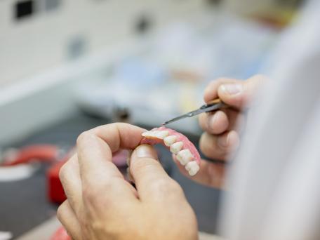 Zahnersatz wird hergestellt