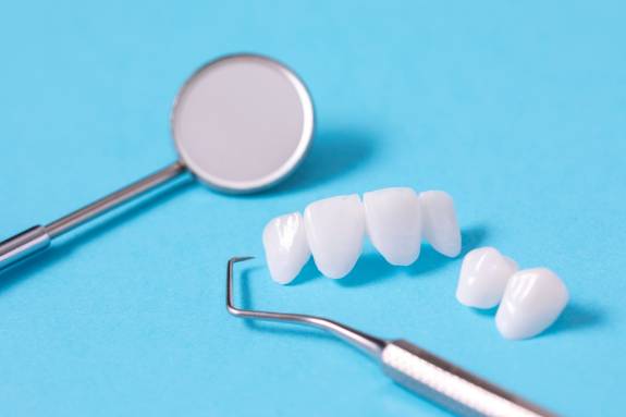 Veneers liegen auf blauem Untergrund